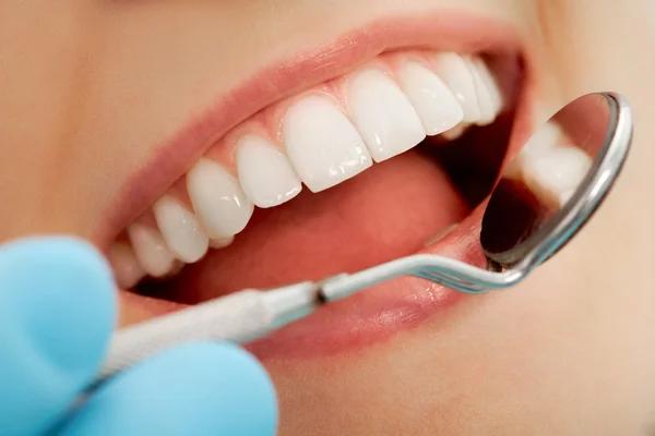 Top-Rated Dentist in North Vancouver for Healthy Smiles