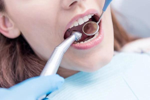 Affordable Implants Near Me with Expert Dental Solutions